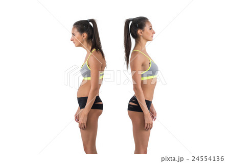 Woman with impaired posture position defect 24554136