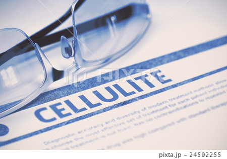 Diagnosis - Cellulite. Medicine Concept. 3D Diagnosis - Cellulite. Medicine Concept. 3D 24592255