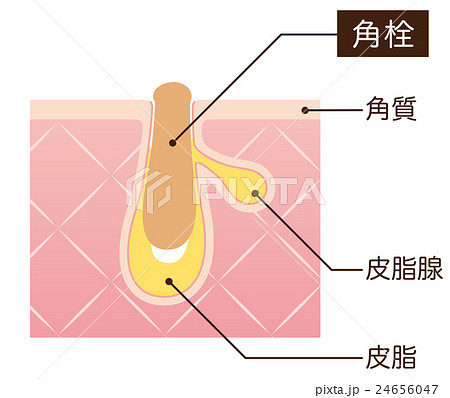 毛穴の構造 角栓 断面図 毛穴の構造 角栓 断面図 24656047