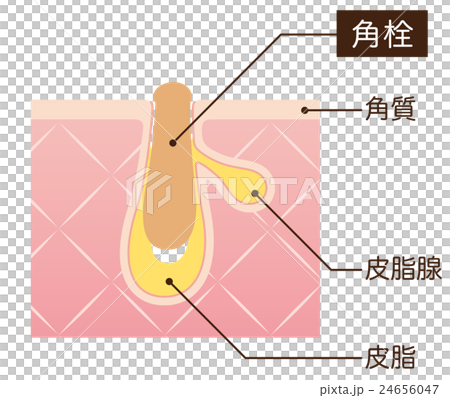 毛穴の構造 角栓 断面図 毛穴の構造 角栓 断面図 24656047