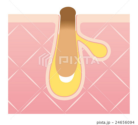 毛穴の構造 角栓 断面図 毛穴の構造 角栓 断面図 24656094