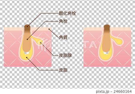 毛穴の構造　角栓　断面図 24660164