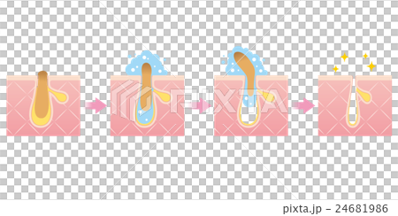 角栓の洗浄　毛穴の構造 24681986