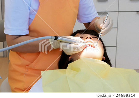 プロケア・スケーリング（歯の清掃） 24699314