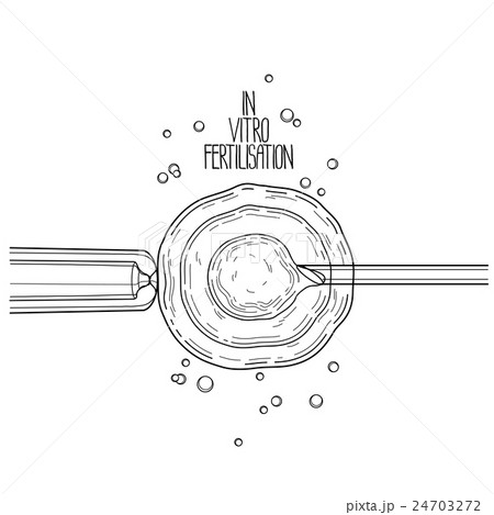 In vitor fertilisation 24703272