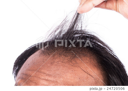 young men show hair young men show hair 24720506