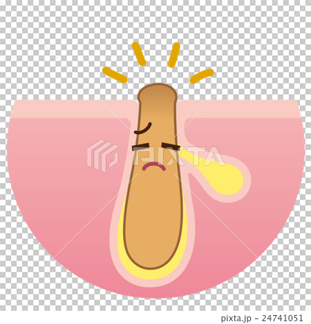 角栓の洗浄　毛穴の構造 24741051