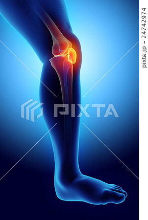 3D illustration of Patella, medical concept. 3D illustration of Patella, medical concept. 24742974
