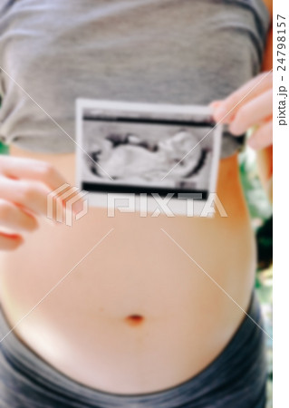 Pregnant Woman Holding Ultrasound Scan Photo 24798157