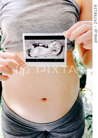 Pregnant Woman Holding Ultrasound Scan Photo 24798159