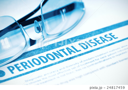 Periodontal Disease. Medicine. 3D Illustration. Periodontal Disease. Medicine. 3D Illustration. 24817459