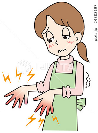 アカギレの女性 24888197