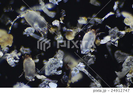 顕微鏡でみたハウスダストとダニ 24912747