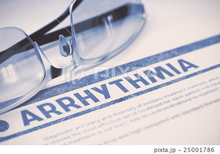 Arrhythmia. Medicine. 3D Illustration. 25001786