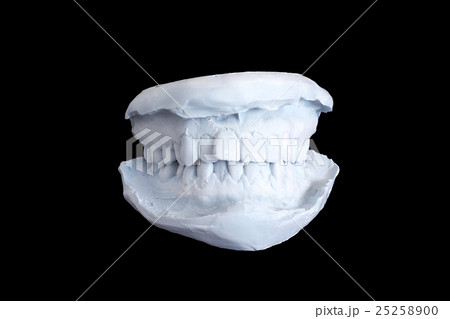 Dental examining, plaster dents model isolated Dental examining, plaster dents model isolated 25258900