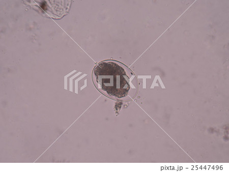 Hookworm is a parasitic nematode that 25447496