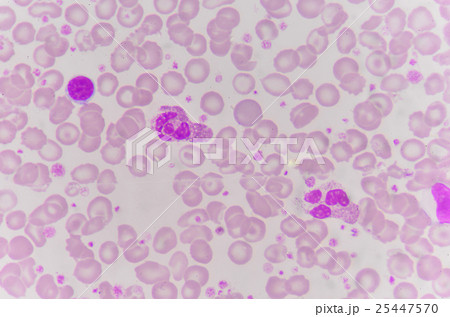 red blood cells with white blood cells background. 25447570