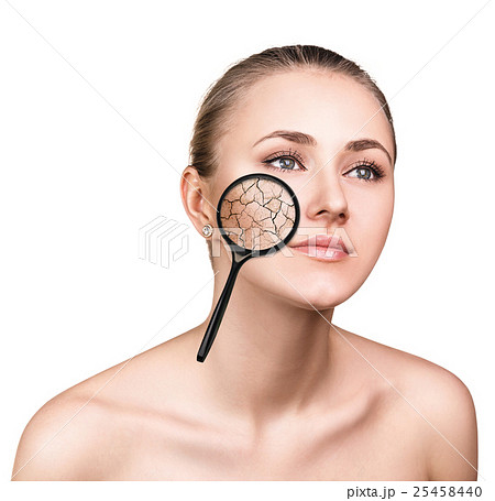 Face of young woman with dry skin. Face of young woman with dry skin. 25458440