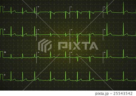electrocardiogram on dark background 25543542