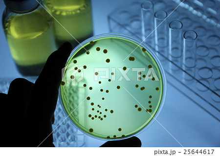 研究イメージ 微生物検査 研究イメージ 微生物検査 25644617