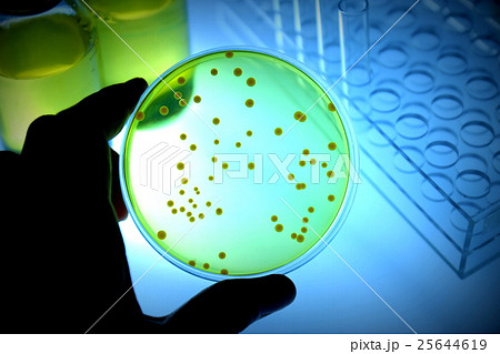 研究イメージ 微生物検査 研究イメージ 微生物検査 25644619