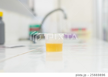 Urine specimen for Urine examination in Urine specimen for Urine examination in 25669896