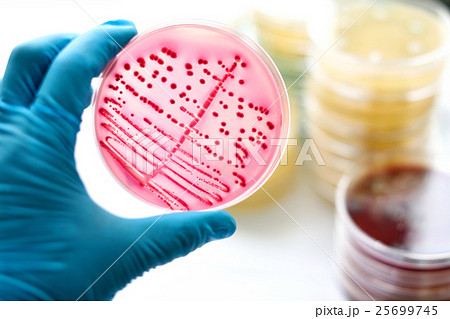 Colonies of bacteria in MacConkey agar  25699745