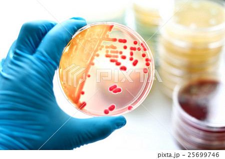 Colonies of bacteria in MacConkey agar  25699746