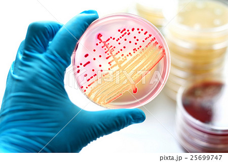Colonies of bacteria in MacConkey agar  25699747