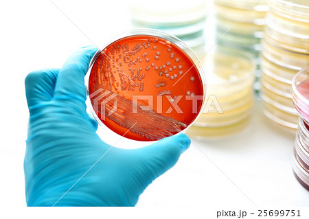 Colonies of bacteria in blood agar Colonies of bacteria in blood agar 25699751