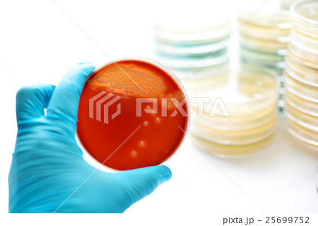 Colonies of bacteria in blood agar Colonies of bacteria in blood agar 25699752