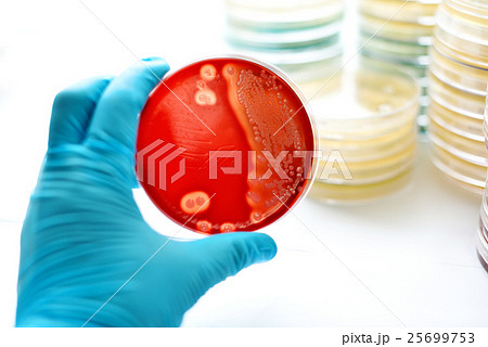 Colonies of bacteria in blood agar  25699753