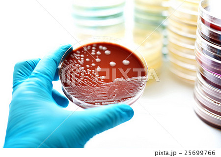 Bacteria culture in petri dish Bacteria culture in petri dish 25699766