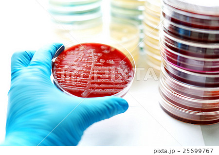 Bacteria culture in petri dish 25699767