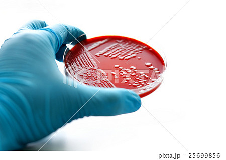 Colonies of bacteria in blood agar  25699856