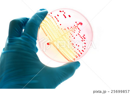 Colonies of bacteria in MacConkey agar  25699857