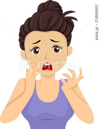 Teen Girl Pimple Breakout 25806662