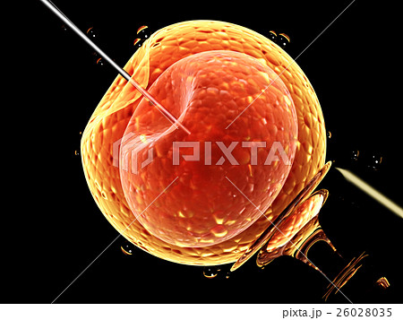 Artificial insemination Artificial insemination 26028035