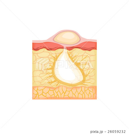 Dermatology Skincare Anatomical Info Illustration Dermatology Skincare Anatomical Info Illustration 26059232