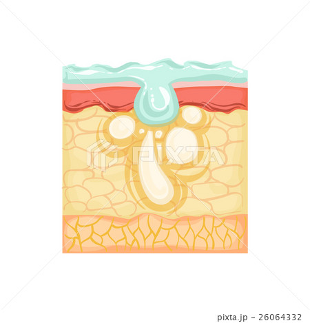 Dermatology Skincare Anatomical Info Illustration 26064332