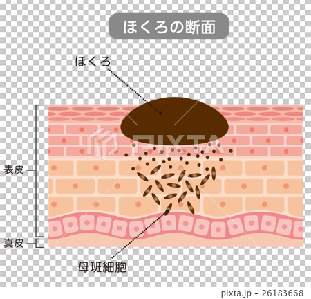 Moles cross section medical care 26183668
