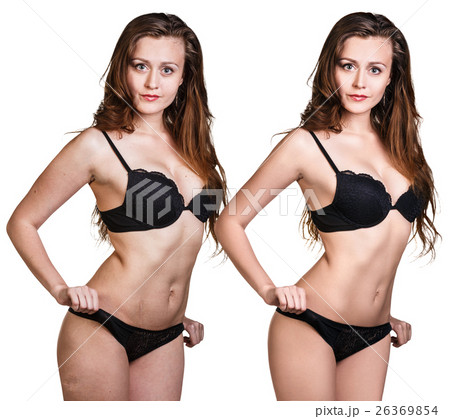 Woman body before and after retouch. 26369854