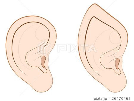 Human Ear Pointed Ear Elf Comparison 26470462