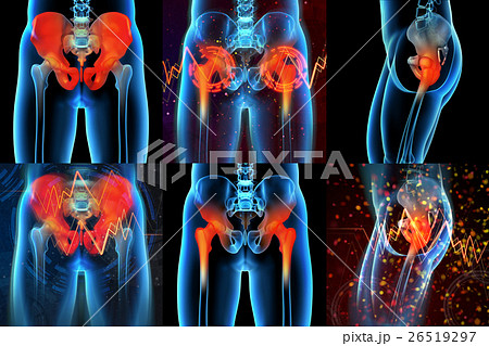 3d rendering  medical illustration of a sacrum 26519297