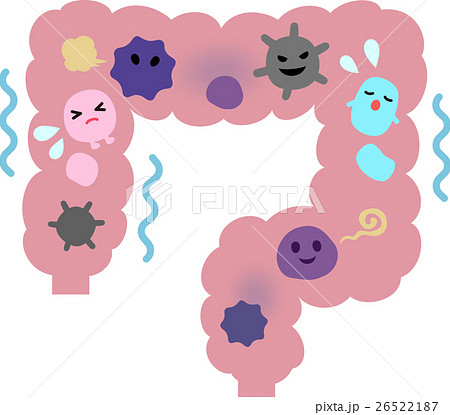 悪玉菌が活発な大腸のイメージ 悪玉菌が活発な大腸のイメージ 26522187