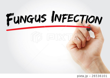 Hand writing Fungus infection with marker Hand writing Fungus infection with marker 26536101