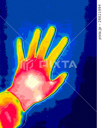 サーモグラフ・イメージ サーモグラフ・イメージ 26621994