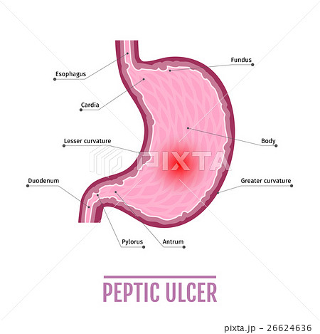 medical illustration of the human stomach with 26624636