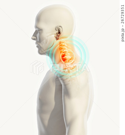 Neck painful - cervica spine, 3D illustration. Neck painful - cervica spine, 3D illustration. 26729351