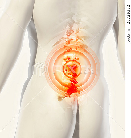 3D Illustration of sacral spine painful. 3D Illustration of sacral spine painful. 26729352